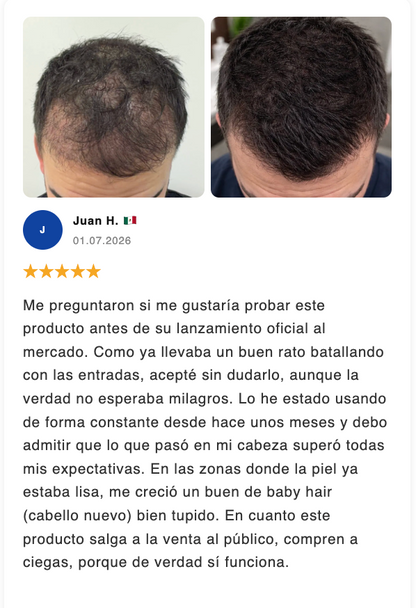 Lenzios Roll-On de Crecimiento Capilar — Activador de Cabello Nuevo